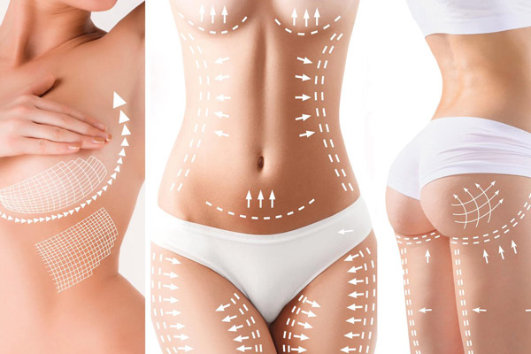 annelik-estetigi-MOMM-MAKEOVER-600x400 Annelik Estetiği - Op. Dr. Ertan Günal Gaziantep