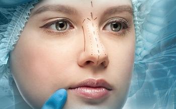 revizyon-rinoplasti Revision Rhinoplasty - Op. Dr. Ertan Günal Gaziantep